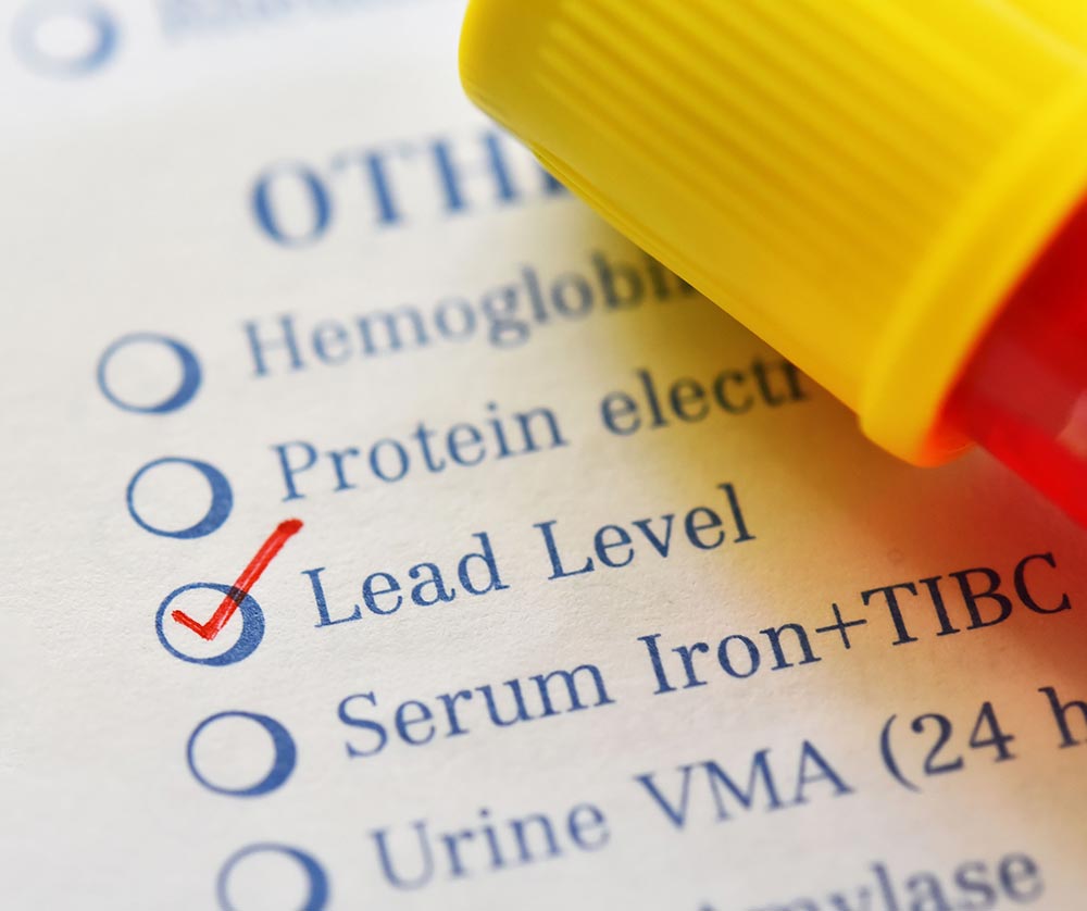Lead Testing